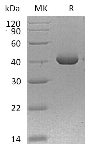 BL-0092NP: Greater than 95% as determined by reducing SDS-PAGE. (QC verified)Recombinant Mouse TACI Protein (C-Fc)