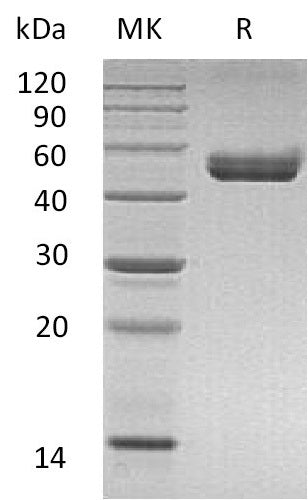 BL-1904NP: Greater than 95% as determined by reducing SDS-PAGE. (QC verified)Recombinant Mouse CD74 Protein (C-mFc-6His)