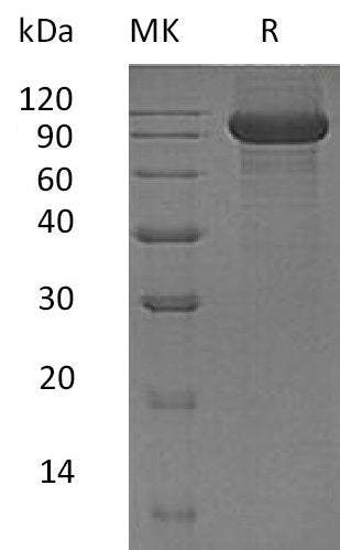BL-1619NP: Greater than 95% as determined by reducing SDS-PAGE. (QC verified)Recombinant Human Kell Protein (C-6His)
