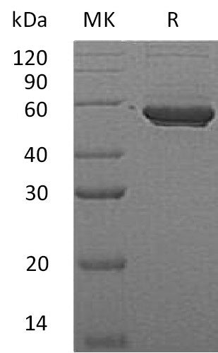 BL-0955NP: Greater than 95% as determined by reducing SDS-PAGE. (QC verified)Recombinant Human PIP4K2A Protein (C-6His)