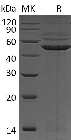 BL-0953NP: Greater than 95% as determined by reducing SDS-PAGE. (QC verified)Recombinant Human PRKAR1A Protein (C-6His)