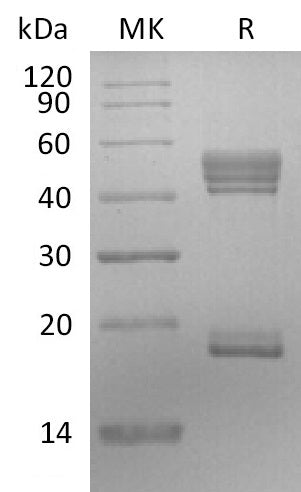 BL-2111NP: Greater than 95% as determined by reducing SDS-PAGE. (QC verified)Recombinant Human IL-23 Protein (C-6His)