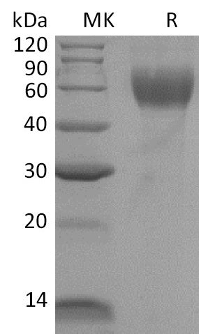 BL-2100NP: Greater than 95% as determined by reducing SDS-PAGE. (QC verified)Recombinant Mouse IL-1R1 Protein (C-6His)