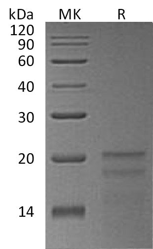 BL-1549NP: Greater than 95% as determined by reducing SDS-PAGE. (QC verified)Recombinant Human ZNHIT1 Protein (N-6His)