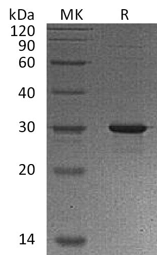 BL-1547NP: Greater than 90% as determined by reducing SDS-PAGE. (QC verified)Recombinant Human GAMT Protein (N, C-6His)