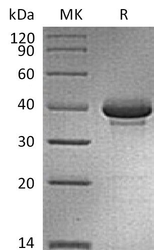 BL-0080NP: Greater than 90% as determined by reducing SDS-PAGE. (QC verified)Recombinant Human CALCB Protein (C-Fc)