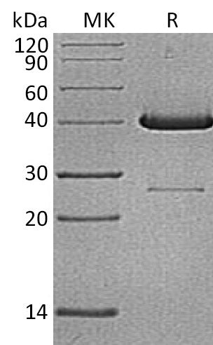 BL-0256NP: Greater than 95% as determined by reducing SDS-PAGE. (QC verified)