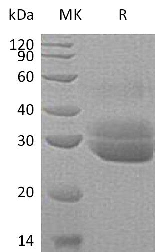 BL-0897NP: Greater than 95% as determined by reducing SDS-PAGE. (QC verified)Recombinant Human EPDR1 Protein (C-6His)