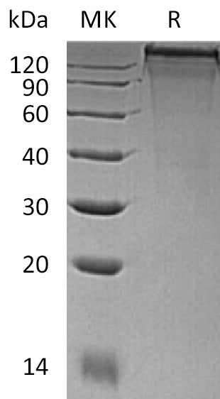 BL-1584NP: Greater than 95% as determined by reducing SDS-PAGE. (QC verified)Recombinant Mouse COL3A1 Protein (C-6His)