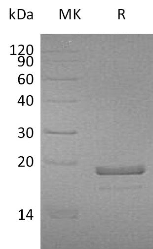 BL-1585NP: Greater than 95% as determined by reducing SDS-PAGE. (QC verified)Recombinant Human MDP1 Protein (C-6His)