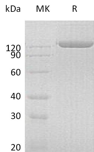 BL-0083NP: Greater than 95% as determined by reducing SDS-PAGE. (QC verified)Recombinant Human pIgR Protein (C-Fc)