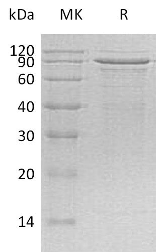 BL-0899NP: Greater than 90% as determined by reducing SDS-PAGE. (QC verified)Recombinant Human MECP2 Protein (C-6His)