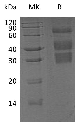 BL-0903NP: Greater than 95% as determined by reducing SDS-PAGE. (QC verified)Recombinant Mouse Clusterin Protein (C-6His)