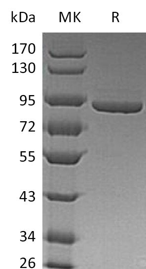 BL-1590NP: Greater than 95% as determined by reducing SDS-PAGE. (QC verified)Recombinant Human PFKM Protein (C-6His)