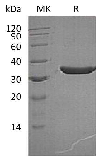 BL-1588NP: Greater than 95% as determined by reducing SDS-PAGE. (QC verified)Recombinant Human KLK3 Protein (236AA, C-6His)