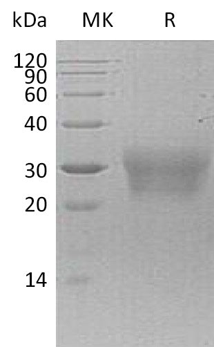 BL-0914NP: Greater than 95% as determined by reducing SDS-PAGE. (QC verified)Recombinant Human NPDC1 Protein (C-6His)