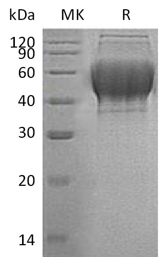 BL-0911NP: Greater than 95% as determined by reducing SDS-PAGE. (QC verified)Recombinant Human TXNDC15 Protein (C-6His)