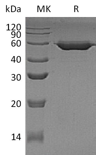 BL-1589NP: Greater than 95% as determined by reducing SDS-PAGE. (QC verified)Recombinant Human AMY2B Protein (C-6His)