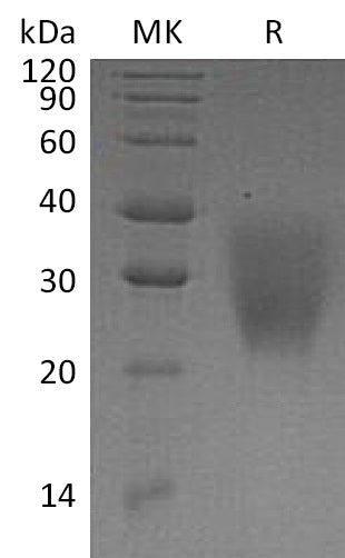BL-0915NP: Greater than 95% as determined by reducing SDS-PAGE. (QC verified)Recombinant Human LRRC25 Protein (C-6His)