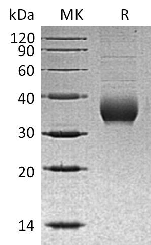 BL-0913NP: Greater than 95% as determined by reducing SDS-PAGE. (QC verified)Recombinant Human CHRNB3 Protein (C-6His)
