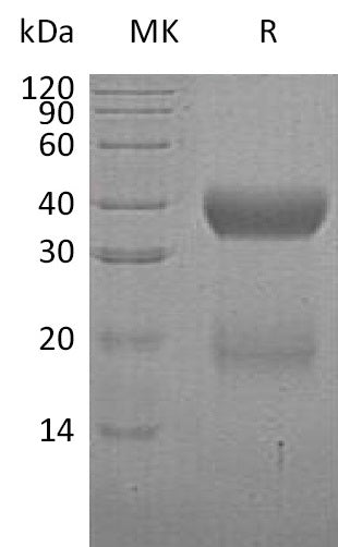 BL-0908NP: Greater than 95% as determined by reducing SDS-PAGE. (QC verified)Recombinant Human VSTM2A Protein (C-6His)