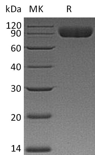 BL-2011NP: Greater than 95% as determined by reducing SDS-PAGE. (QC verified)Recombinant Human SIRPA Protein (C-mIgG2aFc)
