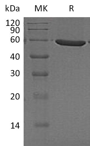 BL-1591NP: Greater than 95% as determined by reducing SDS-PAGE. (QC verified)Recombinant Human PFKFB1 Protein (C-6His)
