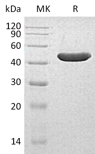 BL-1593NP: Greater than 95% as determined by reducing SDS-PAGE. (QC verified)Recombinant Human INPP5A Protein (C-6His)