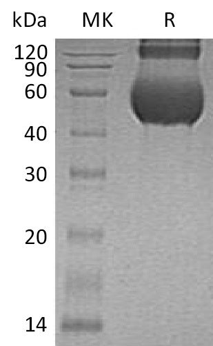 BL-0927NP: Greater than 90% as determined by reducing SDS-PAGE. (QC verified)Recombinant Human CDCP1 Protein (C-6His)