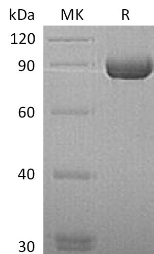 BL-1600NP: Greater than 95% as determined by reducing SDS-PAGE. (QC verified)Recombinant Human MMP-9 Protein (C-6His)