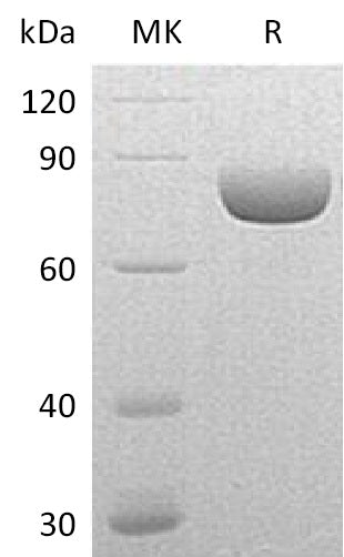 BL-0922NP: Greater than 95% as determined by reducing SDS-PAGE. (QC verified)Recombinant Mouse SEMA4A Protein (C-6His)