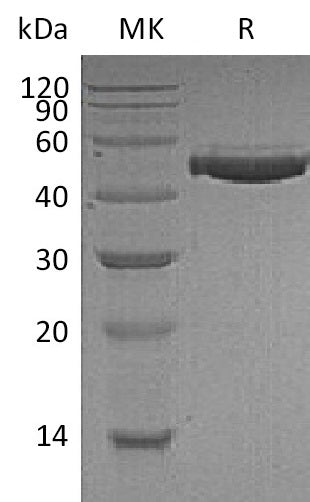 BL-1604NP: Greater than 95% as determined by reducing SDS-PAGE. (QC verified)Recombinant Human CFH Protein (C-6His)