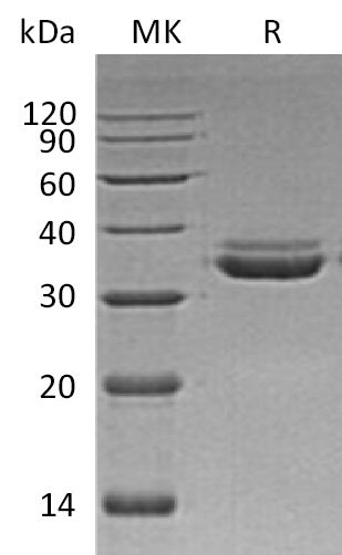 BL-0926NP: Greater than 95% as determined by reducing SDS-PAGE. (QC verified)Recombinant Human LMAN2L Protein (C-6His)