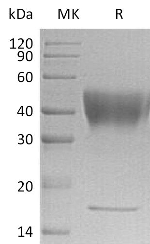 BL-1599NP: Greater than 95% as determined by reducing SDS-PAGE. (QC verified)Recombinant Human IFNGR1 Protein (C-6His)