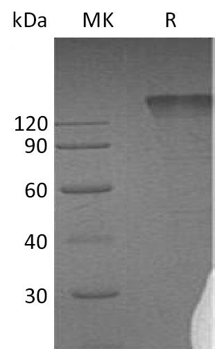 BL-0086NP: Greater than 95% as determined by reducing SDS-PAGE. (QC verified)Recombinant Human SEMA4D Protein (C-Fc)