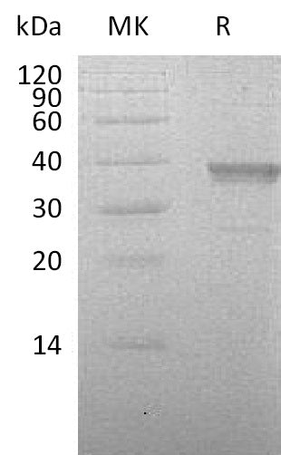 BL-0924NP: Greater than 90% as determined by reducing SDS-PAGE. (QC verified)Recombinant Human HABP2 Protein (C-6His)