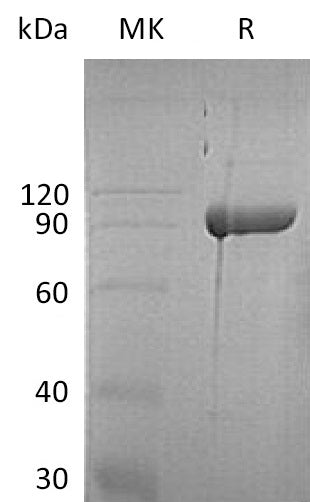 BL-1606NP: Greater than 95% as determined by reducing SDS-PAGE. (QC verified)Recombinant Human ABP1 Protein (C-6His)