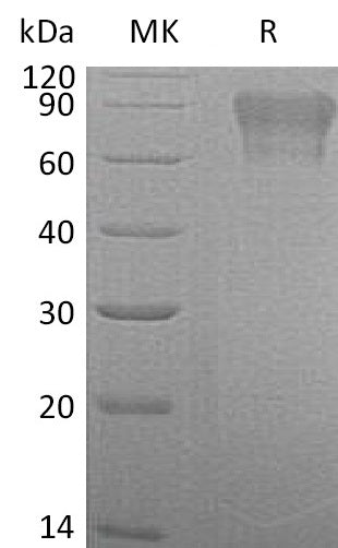 BL-1610NP: Greater than 95% as determined by reducing SDS-PAGE. (QC verified)Recombinant Human Factor IX Protein (C-6His)