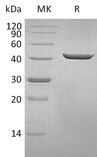 BL-1609NP: Greater than 95% as determined by reducing SDS-PAGE. (QC verified)Recombinant Human SEPHS1 Protein (C-6His)