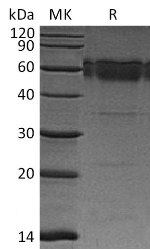 BL-0087NP: Greater than 95% as determined by reducing SDS-PAGE. (QC verified)Recombinant Mouse TRAIL R2 Protein (C-Fc)