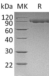 BL-0943NP: Greater than 95% as determined by reducing SDS-PAGE. (QC verified)Recombinant Mouse Serpin G1 Protein (C-6His)