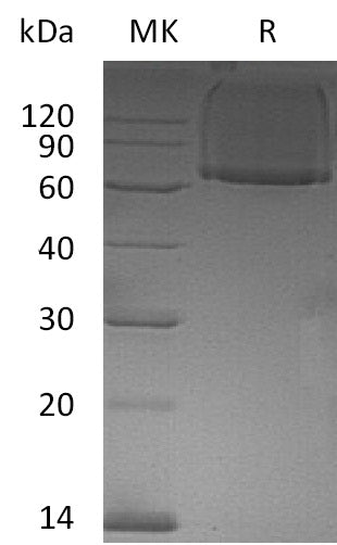 BL-1079NP: Greater than 95% as determined by reducing SDS-PAGE. (QC verified)Recombinant Human GPC1 Protein (N-6His)