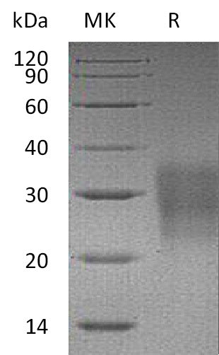BL-1077NP: Greater than 95% as determined by reducing SDS-PAGE. (QC verified)Recombinant Mouse Fas Protein (C-6His)