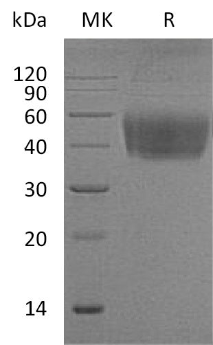 BL-1081NP: Greater than 95% as determined by reducing SDS-PAGE. (QC verified)Recombinant Mouse B7-1 Protein (C-6His)