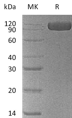 BL-1074NP: Greater than 95% as determined by reducing SDS-PAGE. (QC verified)Recombinant Human NCAM-1 Protein (C-6His)