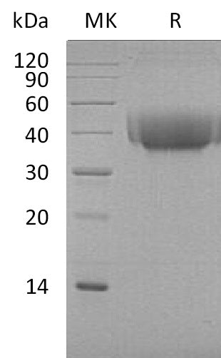 BL-1080NP: Greater than 95% as determined by reducing SDS-PAGE. (QC verified)Recombinant Cynomolgus B7-1 Protein (C-6His)