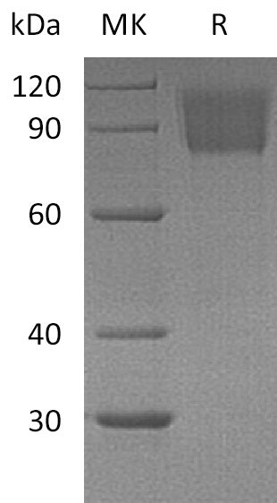 BL-1059NP: Greater than 95% as determined by reducing SDS-PAGE. (QC verified)Recombinant Mouse PDGFRA Protein (C-6His)