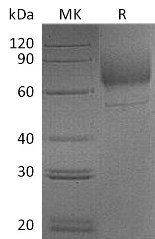 BL-1060NP: Greater than 95% as determined by reducing SDS-PAGE. (QC verified)Recombinant Mouse LIMPII Protein (C-6His)