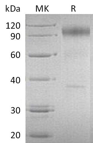 BL-0151NP: Greater than 90% as determined by reducing SDS-PAGE. (QC verified)Recombinant Human IL-23R Protein (C-Fc)