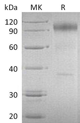 BL-0151NP: Greater than 90% as determined by reducing SDS-PAGE. (QC verified)